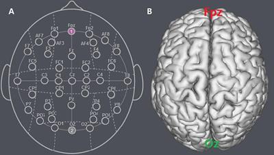 Modulating the Activity of MPFC With tDCS Alters Endowment Effect